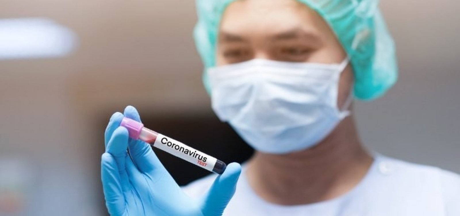 Coronavírus: Brasil chega a 12.400 mortes e 177.589 infectados