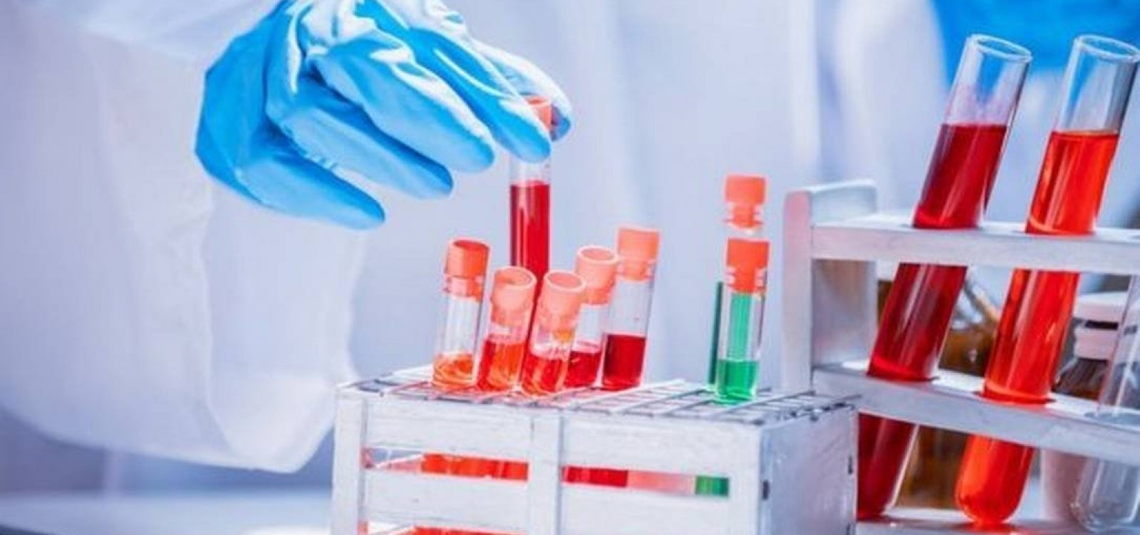 Brasil tem 11.385 novos casos confirmados de Covid-19 e 749 mortes nas últimas 24 horas