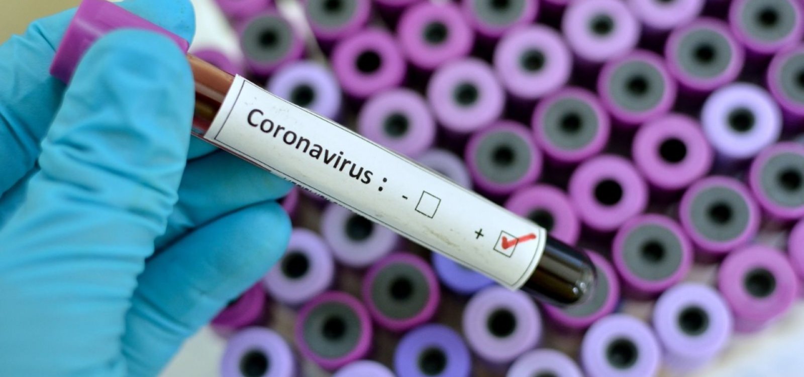 Brasil registra mais 844 mortes por coronavírus e 13.944 novos casos nas últimas 24 horas
