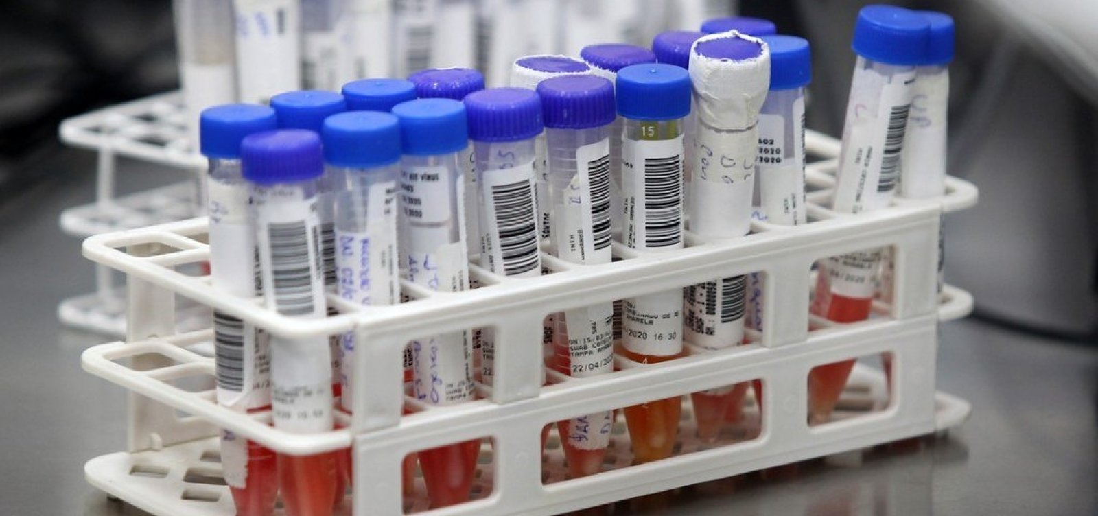Salvador recebe 35 mil novos testes rápidos para coronavírus