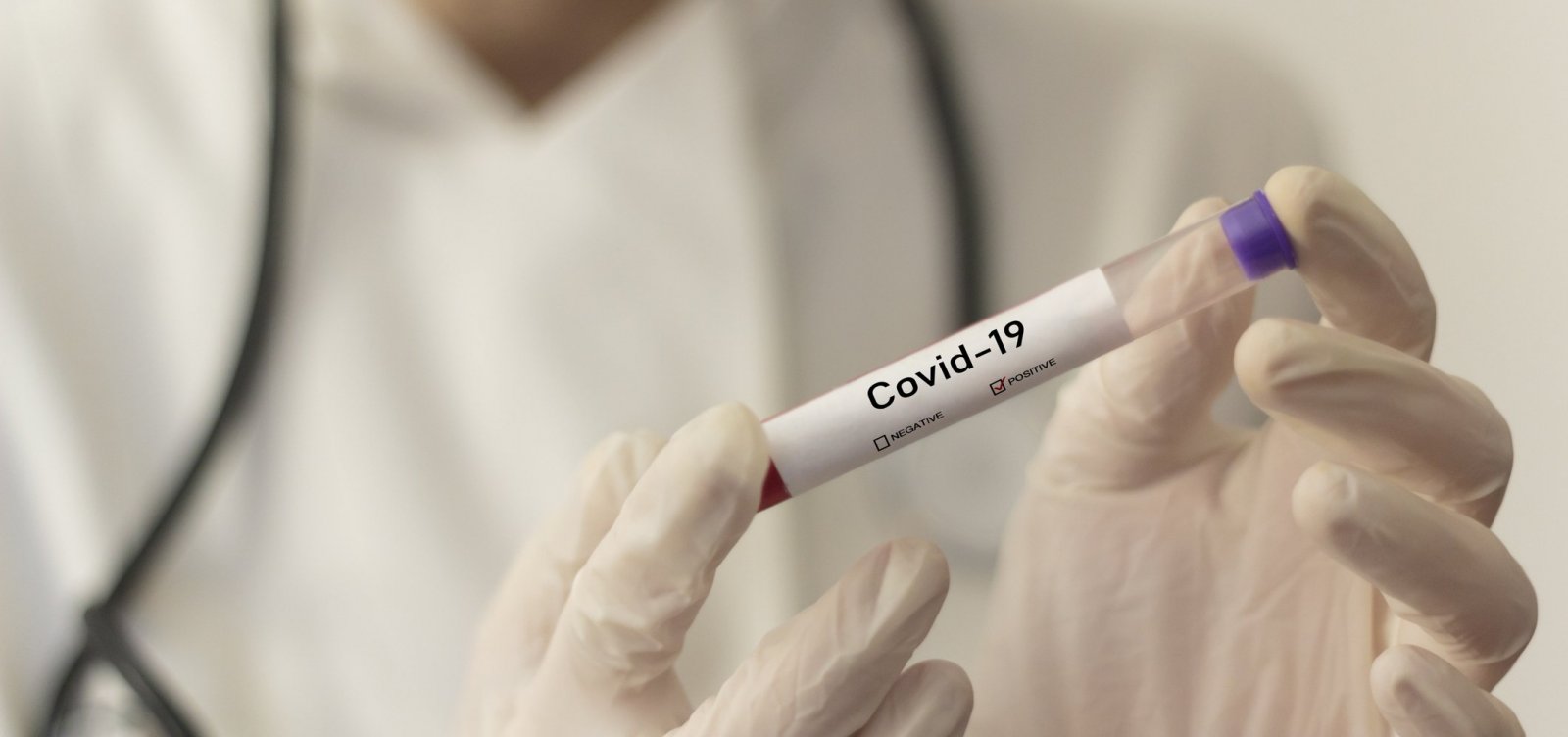 Mais de 2,5 milhões de pessoas estão curadas do coronavírus no mundo
