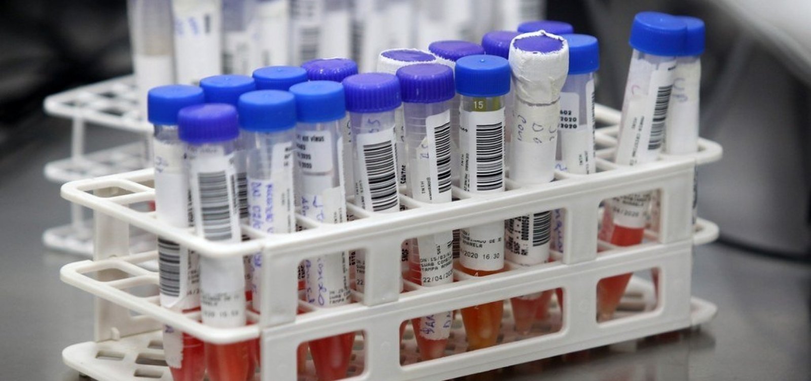 Brasil representa 21% das mortes por Covid-19 no continente americano