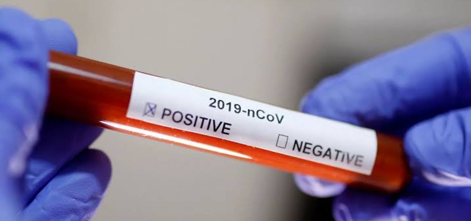 Bahia registra 884 novos casos e 55 mortes por Covid-19 nas últimas 24 horas 