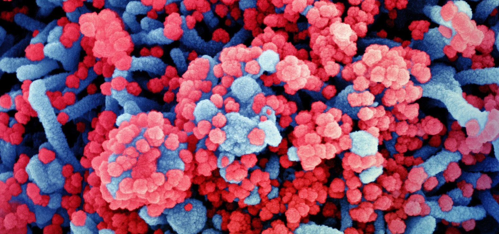 Cientistas anunciam que vacina desenvolvida em Oxford contra o coronavírus é segura e induz imunidade