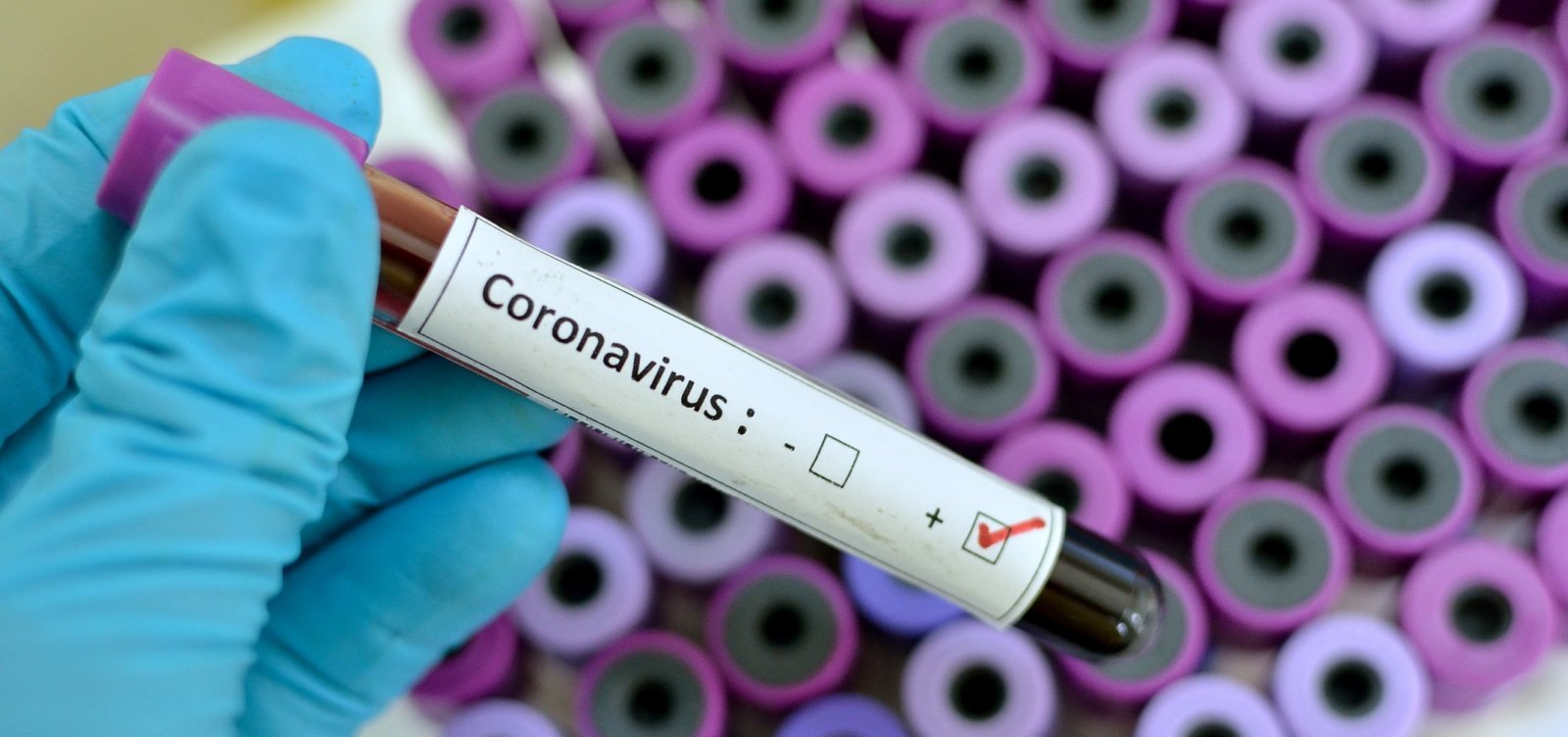 Brasil registra 514 mortes por coronavírus em 24h; total chega a 94.130