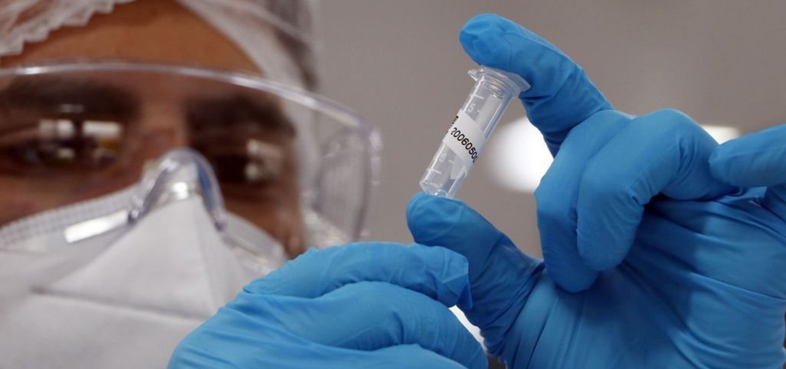 Hospital das Clínicas de SP estuda 7 casos de possível reinfecção pelo coronavírus