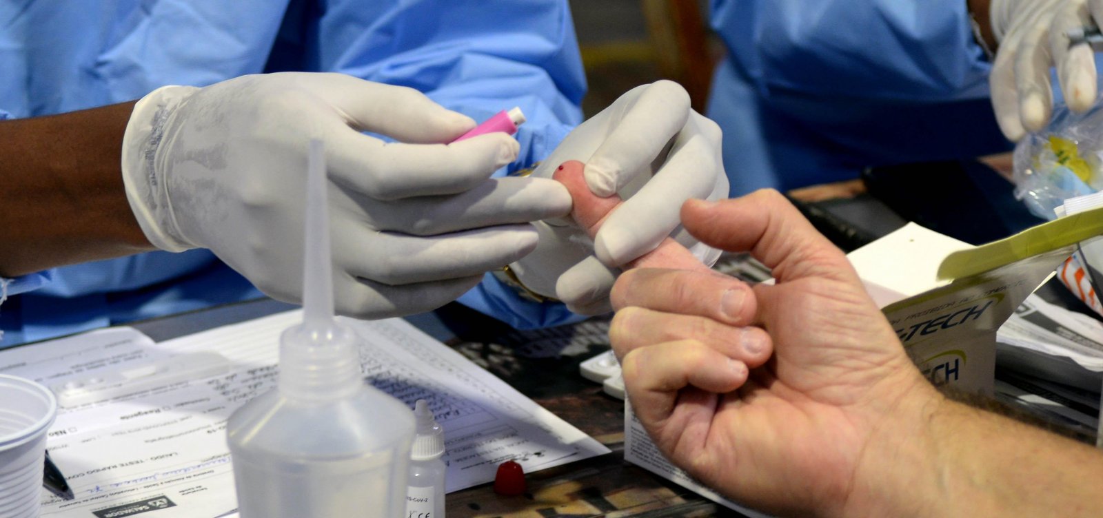 Quantidade de testes rápidos de Covid disponíveis no Brasil apresenta queda